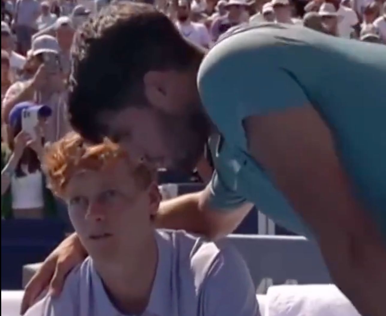 而辛纳则是, 阿卡在摄像